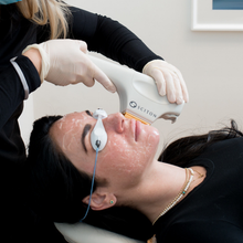 Load image into Gallery viewer, BroadBand Light™ (BBL)