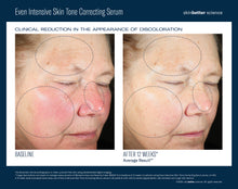 Load image into Gallery viewer, Even Intensive Skin Tone Correcting Serum