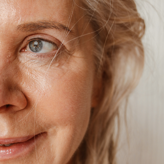 Fine Lines + Wrinkles