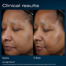 Load image into Gallery viewer, Ampra Volumizing Macro HA Serum
