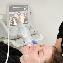 Load image into Gallery viewer, Ultherapy®
