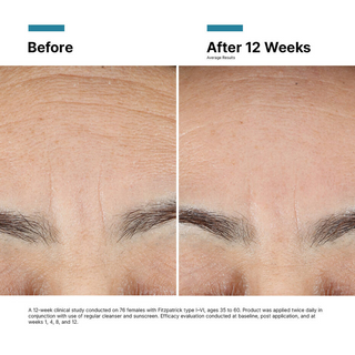 Before and after comparison of skin treatment on a eyebrow area with text indicating results after 12 weeks.