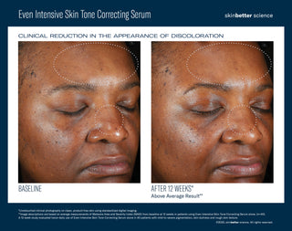 Even Intensive Skin Tone Correcting Serum