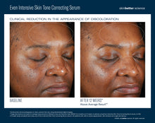 Load image into Gallery viewer, Even Intensive Skin Tone Correcting Serum
