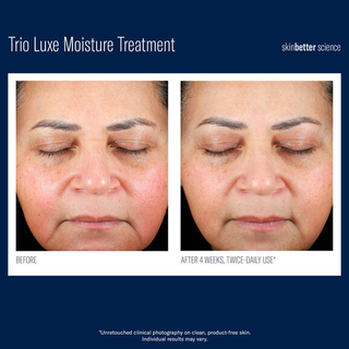 Trio Luxe Before & After Results